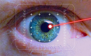 Lasik laser eye surgery Los Angeles, Assil Gaur Eye Institute