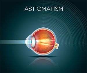Astigmatism: causes, symptoms and treatments, Assil Gaur Eye Institute Los Angeles
